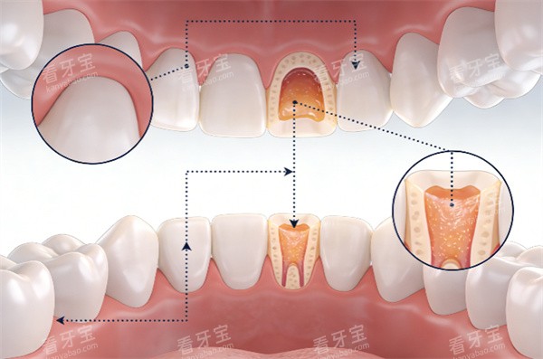 ��������ͨ��ͼƬչʾ