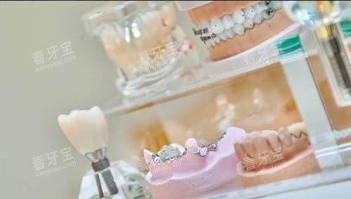 ����ģ��ͼ