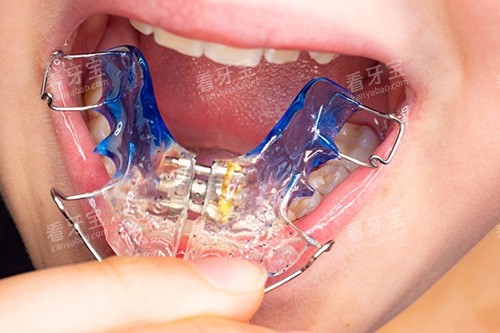 ���ݽ�����ʾ��ͼ