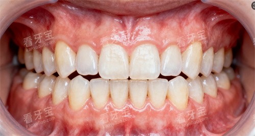 ��������ͼƬ