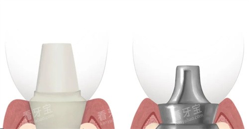 ��ʿ�ٵ�����ֲ����̨���ӶԱ�