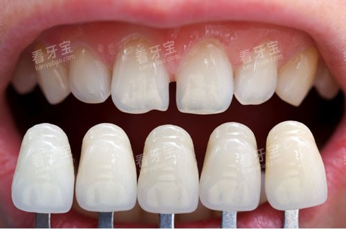 ����������ɫ�Ա�ͼ