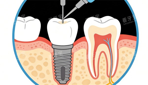 ��ֲ���ݿ�ͨͼ