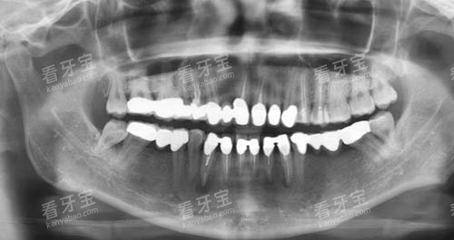 �����޸���ǻct��Ƭ