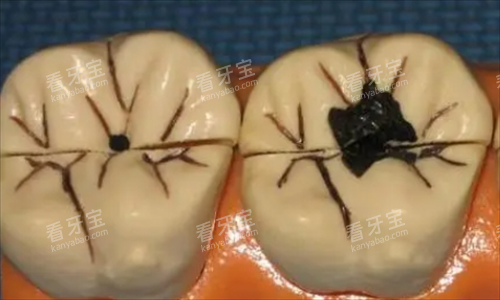 ȣ������ģ��չʾ