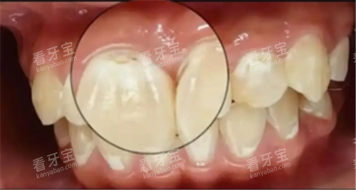 �����ѿ��ͼƬ