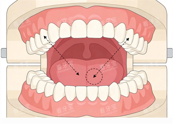 ��������ͨ��ʾ��ͼ