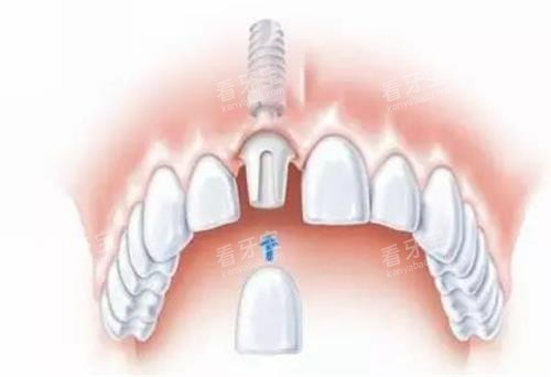 ��ֲ������ֲ��λ