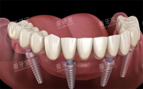 ȫ����ֲ��