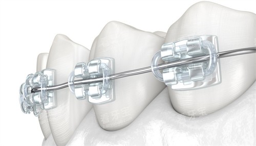 �в۽���ͼʾ