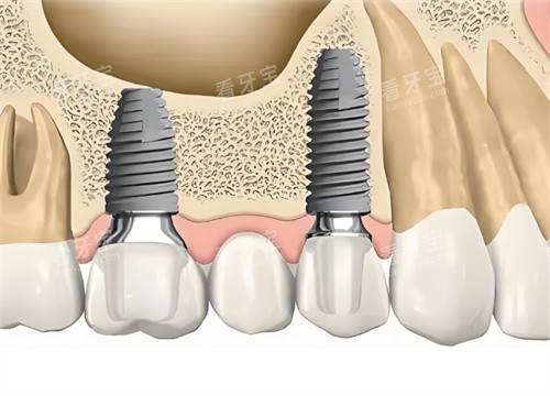 ��ֲ������ͼƬ