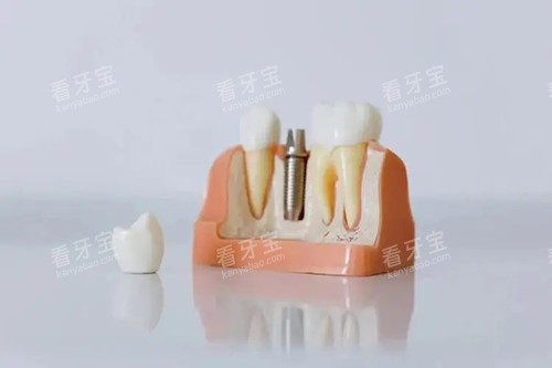 ������ֲ��ģ�Ͱڼ�