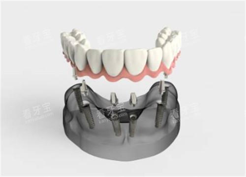 �����ֲ����ͨͼʾ��ͼ