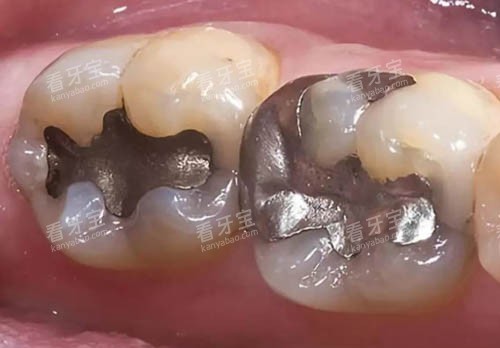 �������ϲ���ϸ��ͼ