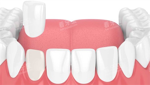 �ڿ�ǻ�ڽ�����������