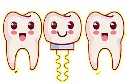 ��ֲ����ͨʾ��ͼ