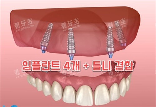 ��ֲ���������ʾ��ͼ