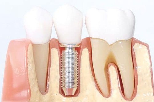 ������ֲ��ģ��ͼ