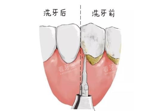 ϴ��ǰ�������