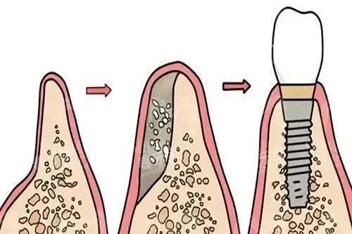 ��ֲ������������ʾ��ͼ