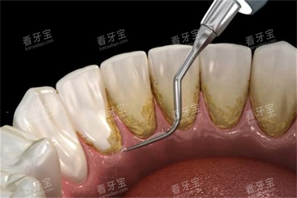 �����۹����ͼ