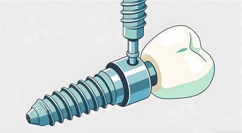 ��ֲ������Ƭչʾͼ