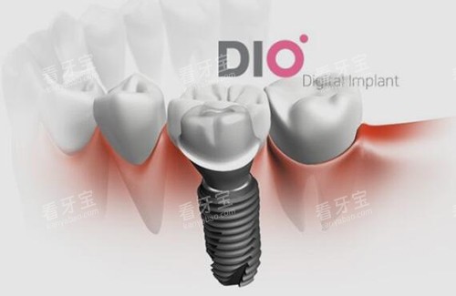 dio������ֲֲ��