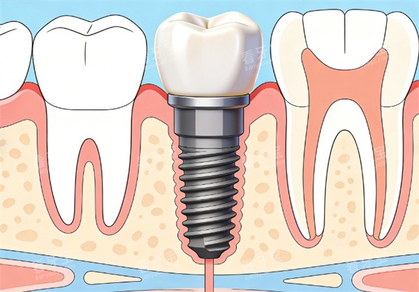 ��ֲ���廭ʾ��ͼ