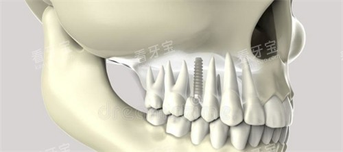 ��ֲ������ͼʾչʾ