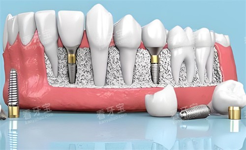 ��ֲ�����϶���չʾ