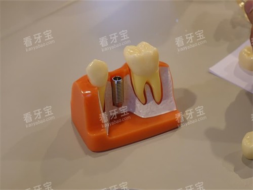 ��ֲ��ֲ�������ģ��ͼ