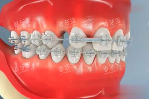 ���ݽ���ģ������