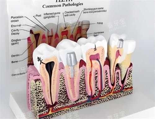 ����ģ�ͽ���ͼƬ