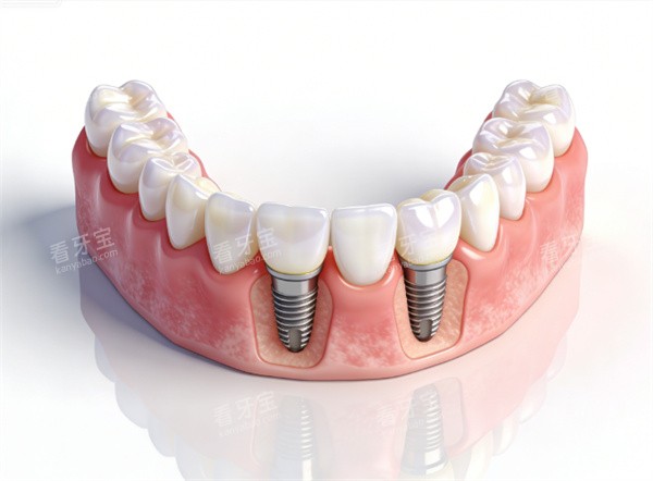 ��ֲ��ģ��չʾʾ��ͼƬ