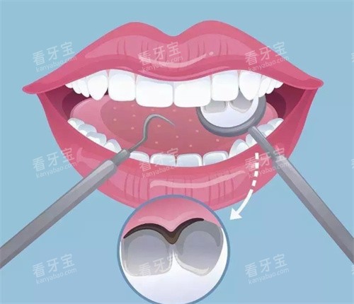 ���ݼ�鿨ͨչʾ