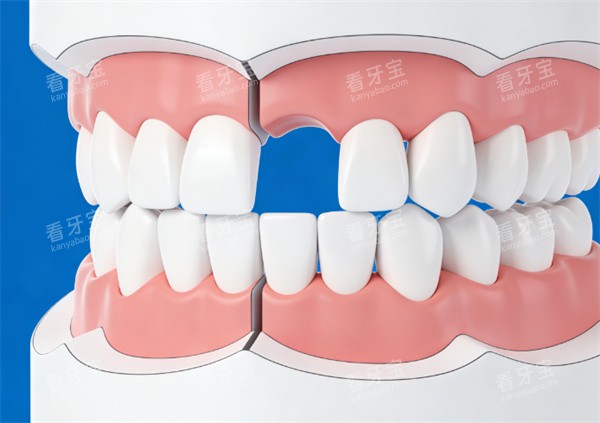 ����ȱʧģ��չʾͼƬ