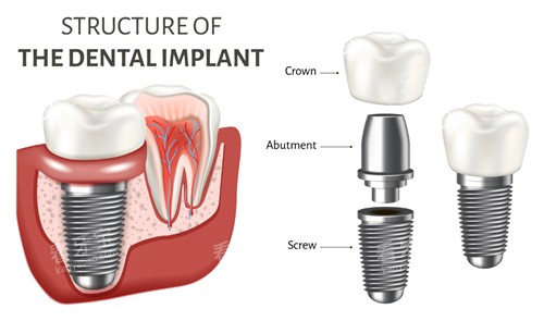 ��ֲ���ṹ