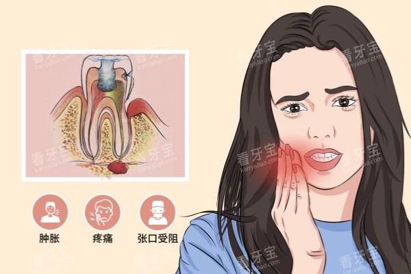 ������ʹ��ͨչʾͼ