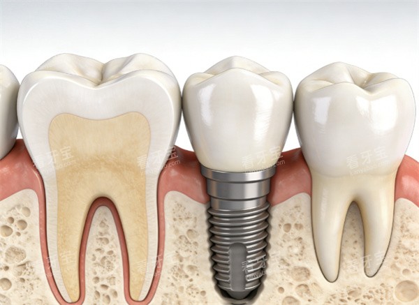 ������ֲ����ʾ��ͼ