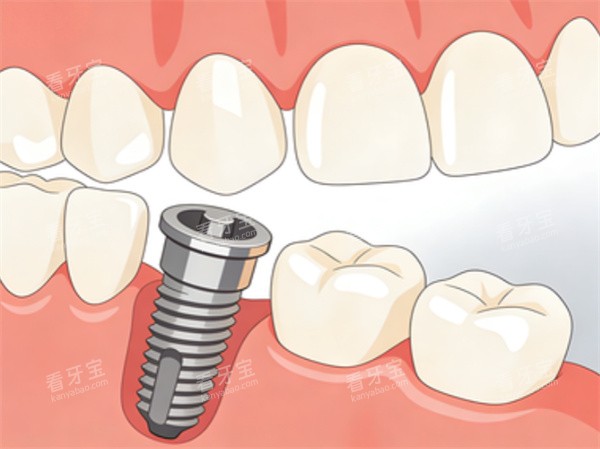 ������ֲ��ͨչʾͼ