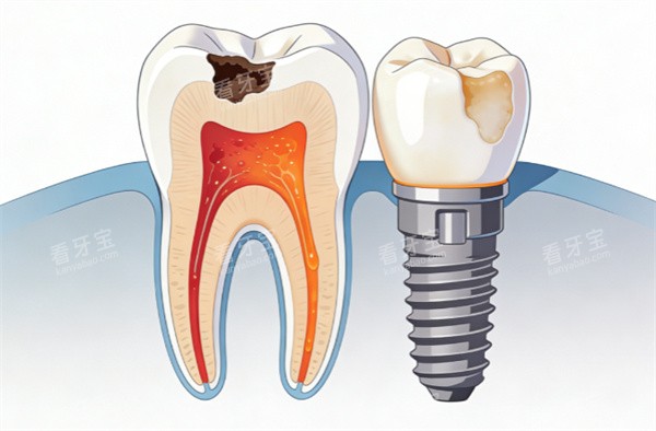 ������ֲ��ͨ����ʾ��ͼ