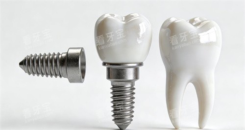 ������ֲ����ͼչʾ