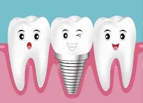 ��ֲ����������ͨʾ��ͼ