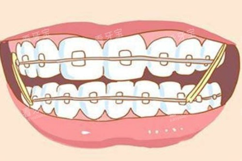 ���ݽ�����ͨͼƬչʾ