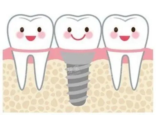 ������ʾ��ͼ