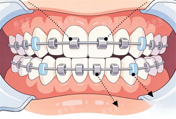 �������ݽ�����ͨͼ