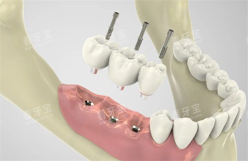 ��ֲ������չʾͼƬ