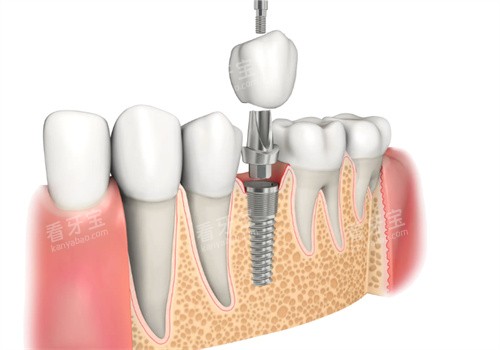 ��ֲ��б��ͼ