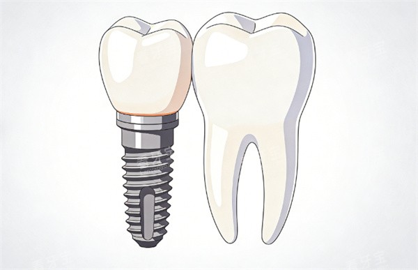 ��ֲ������չʾʾ��ͼ