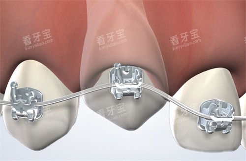 ǣ����������